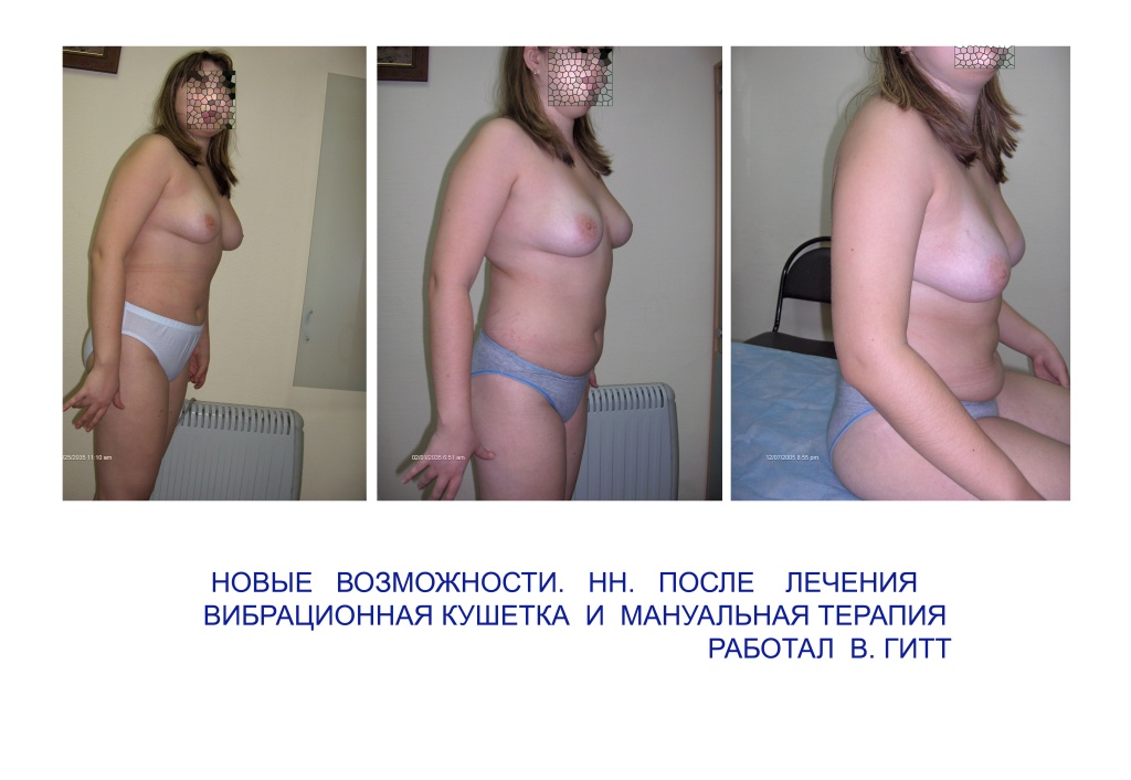 Упражнение по исправлению осанки